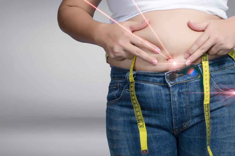 Laser Your Fat After Pregnancy