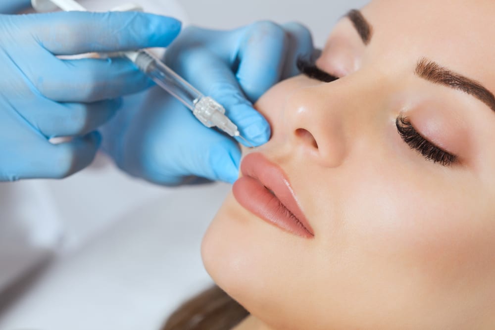 restylane-and-juvederm-lip-fillers-a-new-you-aesthetics