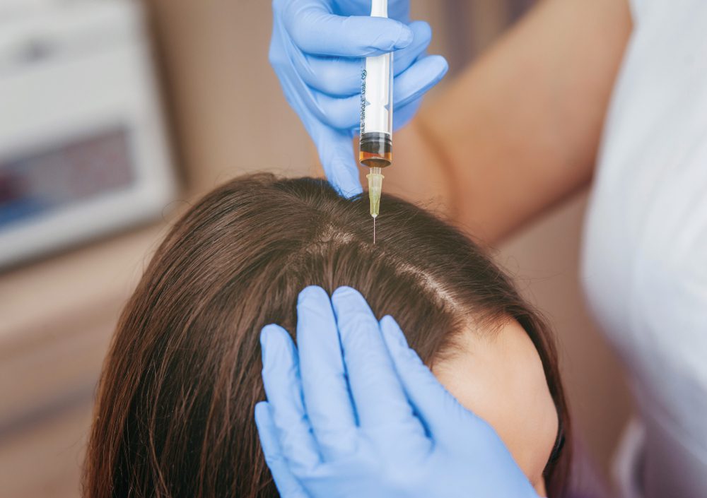 hair restoration