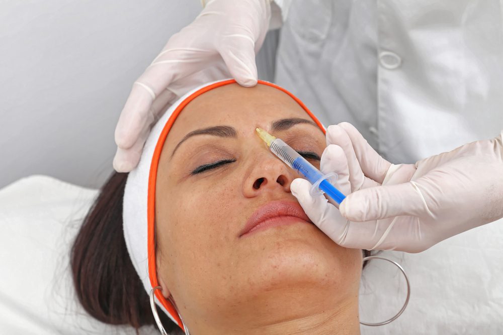 Best Botox Results in Fallbrook California