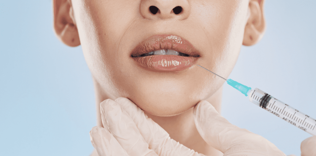 best lasting lip filler