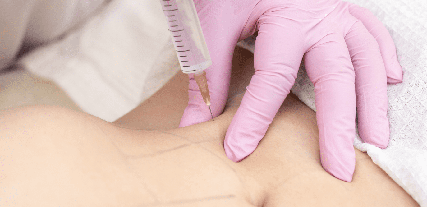 tirzepatide injection cost temecula in Temecula, CA How Much Does Tirzepatide Injections