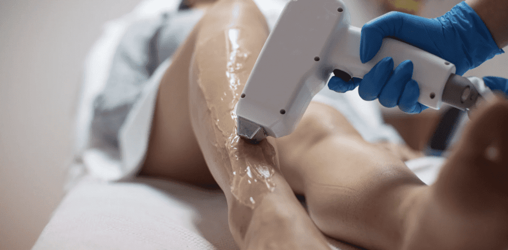 Best Laser Hair Removal Cost
