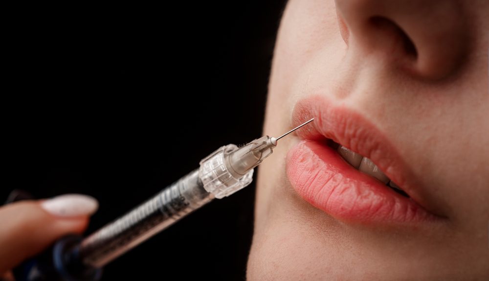 Menifee’s Most Requested Lip Filler Services: Booking Your Perfect Pout