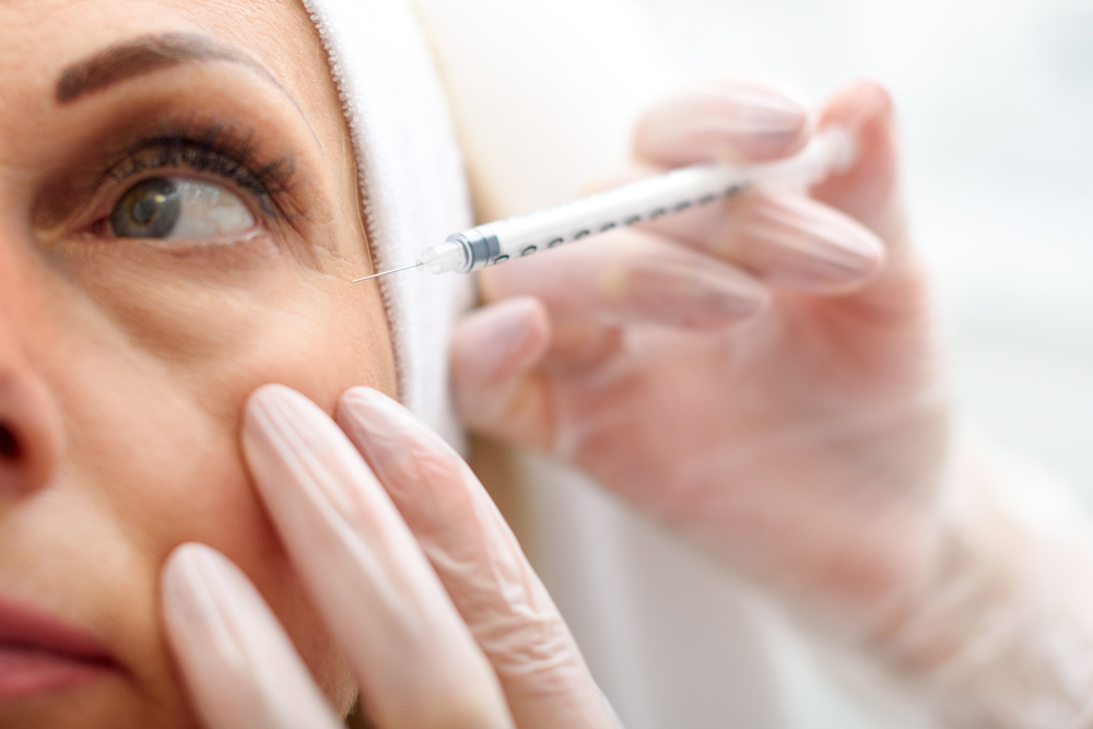 Affordable Botox Unit Costs in Canyon Lake, California for Preventative Use