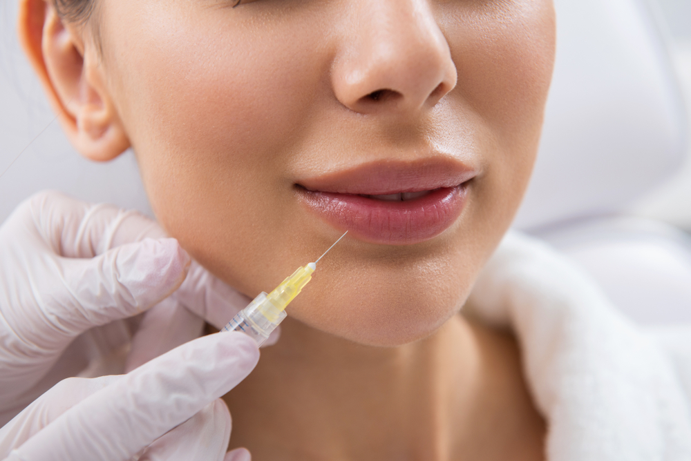 The Best Lip Filler Pricing Options in Menifee, CA