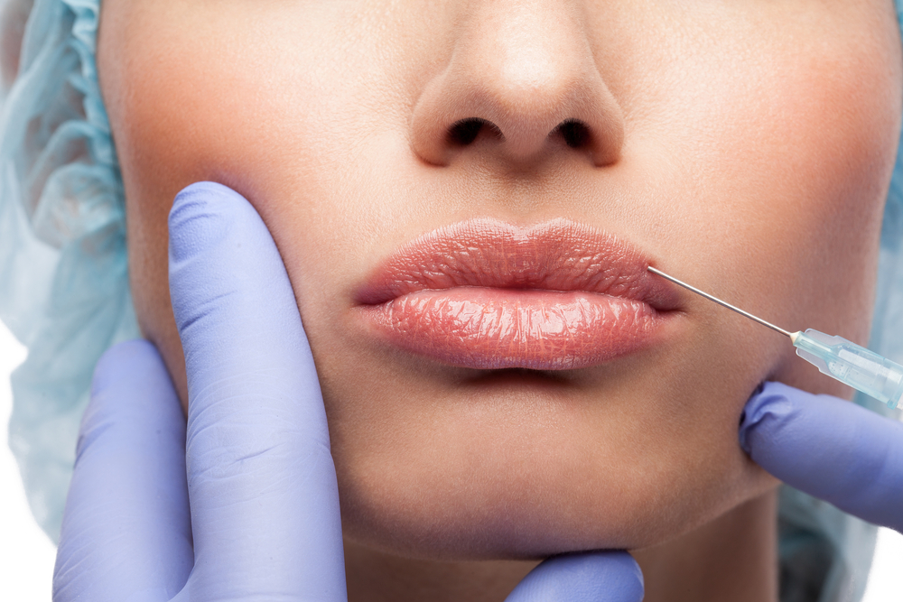 Lip Filler Cost in Murrieta, California for Natural Lip Enhancement