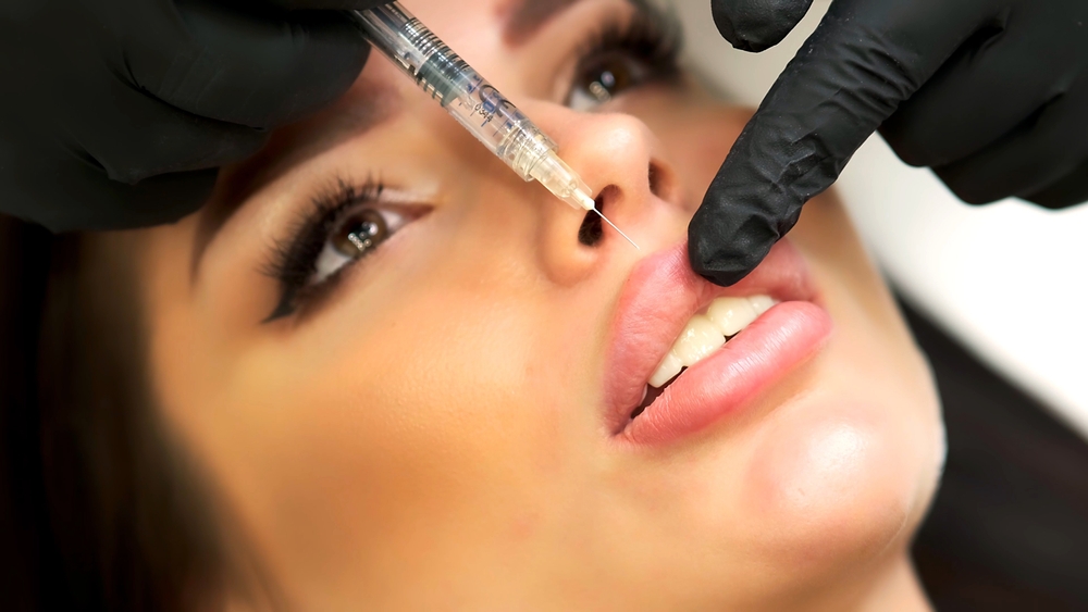 Lip Filler Prices in Temecula, CA: What Patients Should Expect