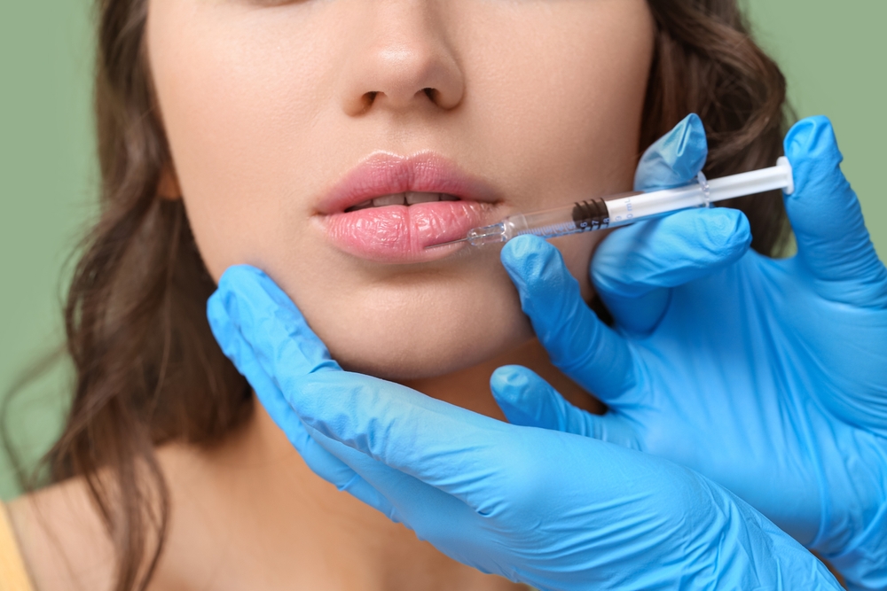 Lip Augmentation Cost in Canyon Lake, California with Minimal Downtime