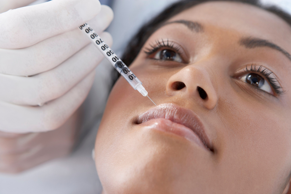 Lip Filler Packages and Volume Enhancement Near Wildomar, CA