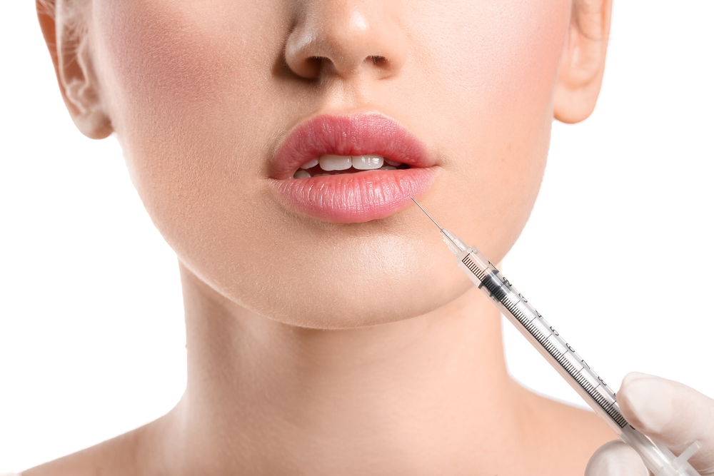 Lip Filler Appointments for Natural Results in Murrieta, California