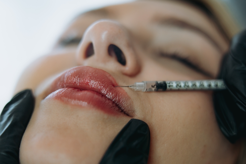 Mini Lip Filler Deals and Specials Near Winchester, California
