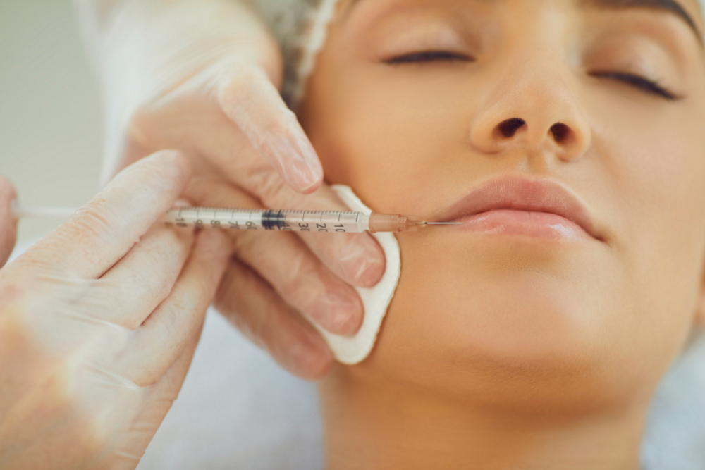 Two Hundred Dollar Mini Lip Filler Special Near Murrieta, CA