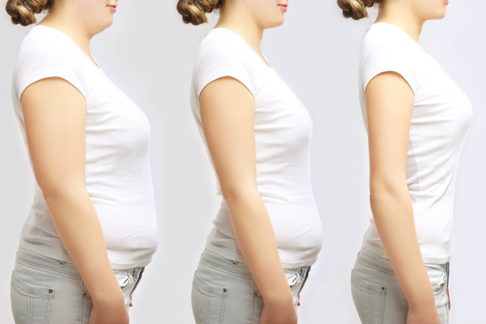Weight Loss Injection Results Timeline in Murrieta, CA