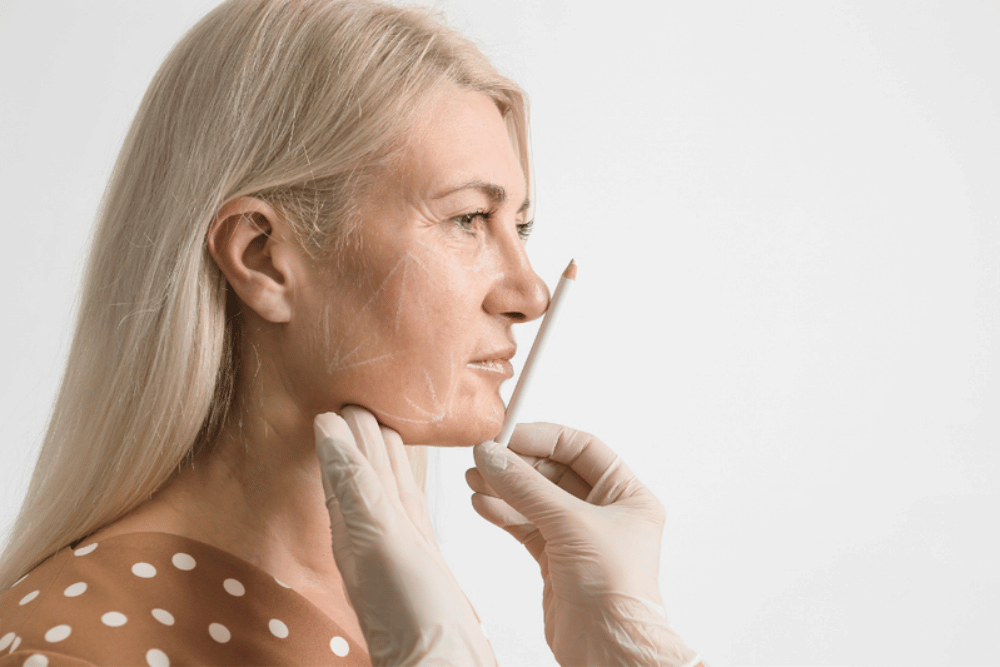 Facial Balancing With Botox and Dermal Fillers in Hemet California