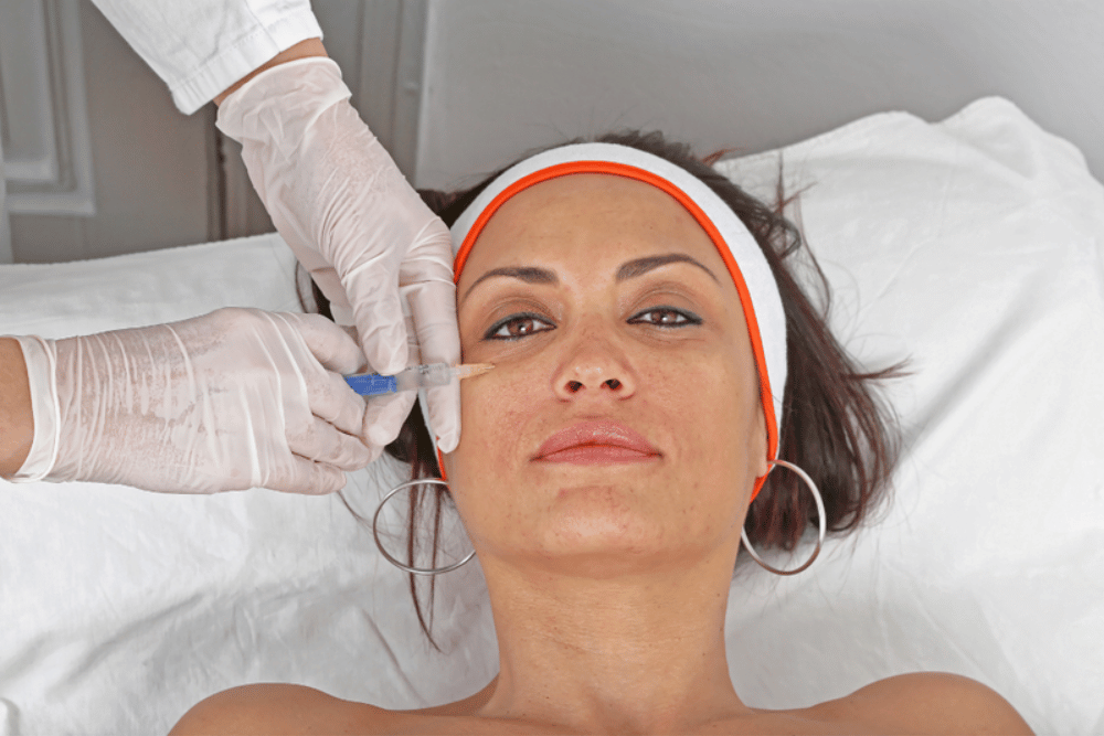 Best Under Eye Filler Treatments for Tired Eyes in Winchester California