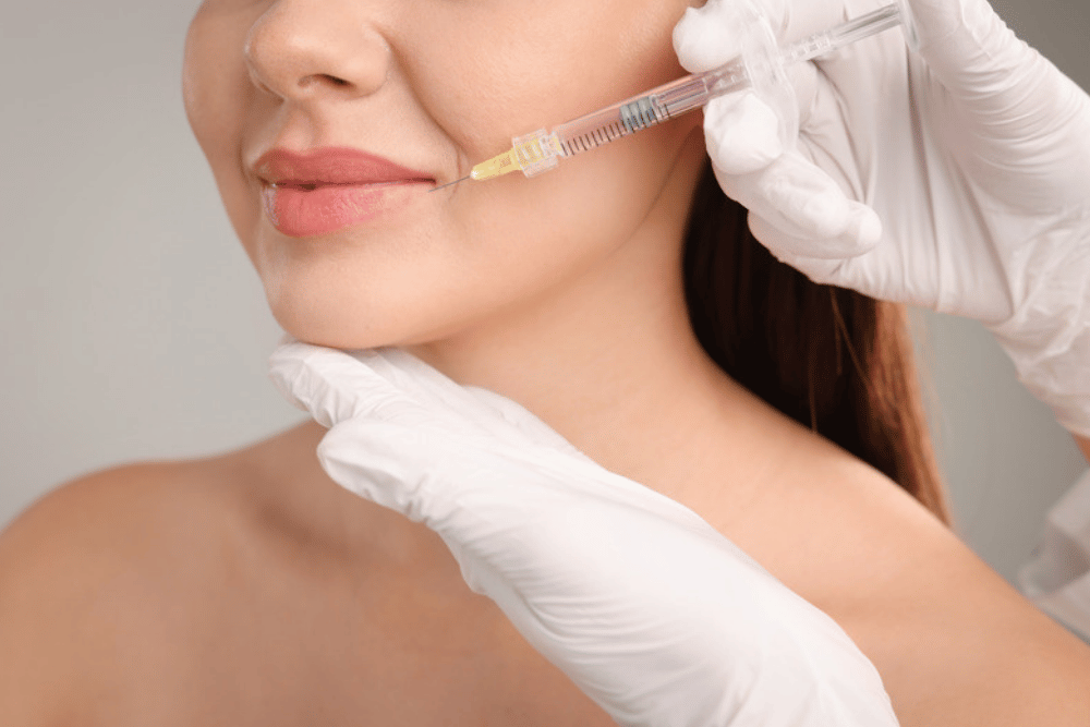 A New U Aesthetics for natural-looking lip fillers