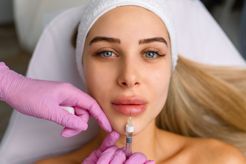 Affordable Lip Filler Treatments in Murrieta, CA for Fuller Natural Lips 
