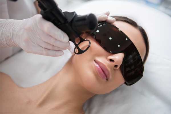 Laser Skin Resurfacing Cost and Recovery in Temecula, CA
