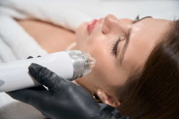 Microneedling RF Skin Tightening Appointment Availability in Murrieta, CA