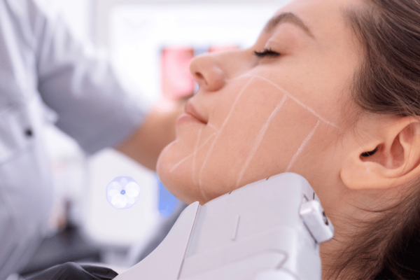 Best Non-Surgical Facelift Treatments Near Temecula California