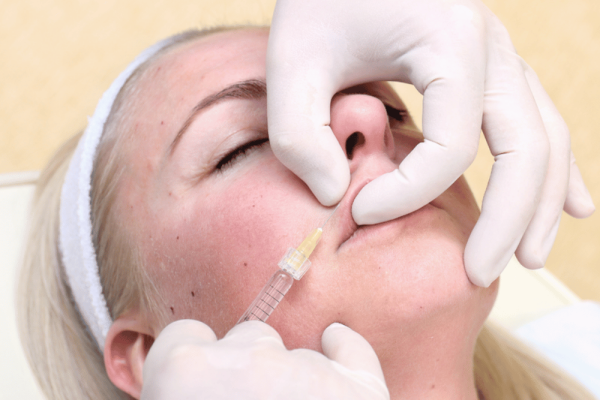 Natural lip filler results at A New U Aesthetics