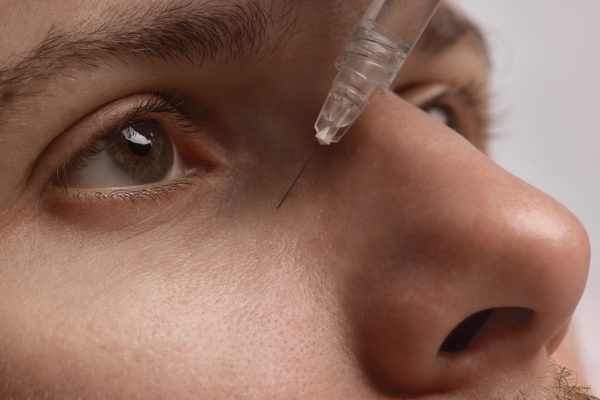 Under Eye Filler vs. PRF Treatments in Temecula, CA: Which Is Best for Tired Eyes? 
