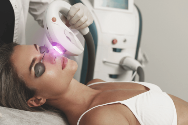 Skin Resurfacing in Temecula CA